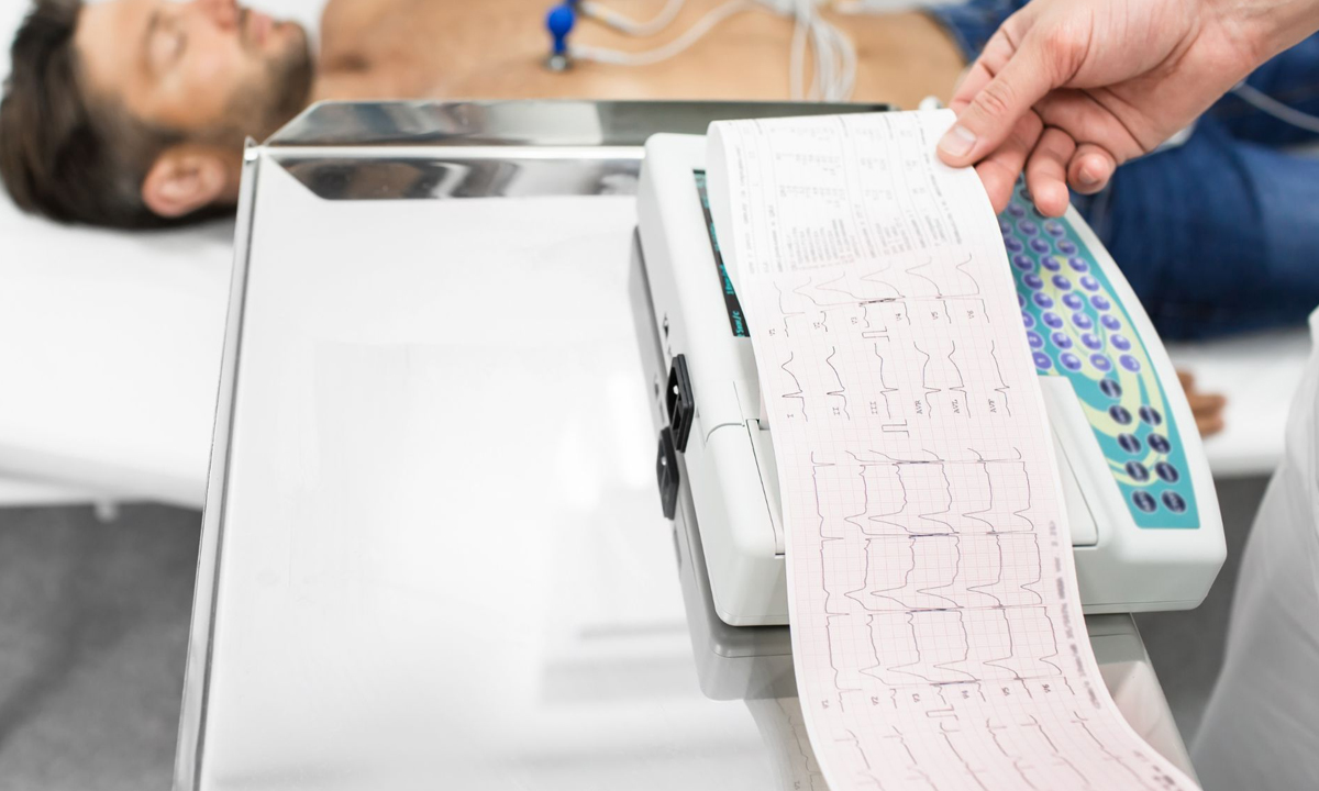 ecg ekg test